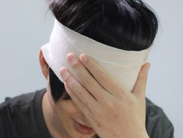 头部缝了四针属于什么伤情