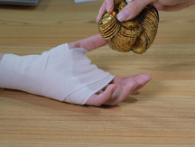 三级残疾是否有补贴金发放
