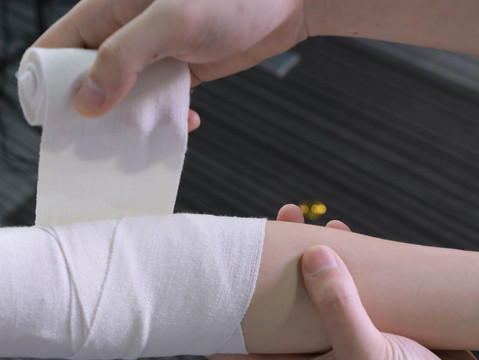 眉骨打开缝针算不算轻伤