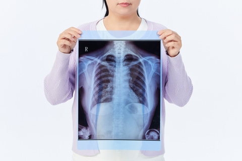 4根肋骨骨折属于几级伤残最新