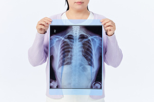 打架造成三根肋骨骨折算几级伤残